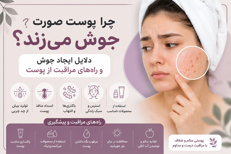 چرا پوست صورت جوش میزند؟ دلایل ایجاد جوش و راههای مراقبت از پوست